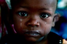 Siyad Ali, 2, a severely malnourished refugee from Somalia, cries after receiving treatment insi.jpg